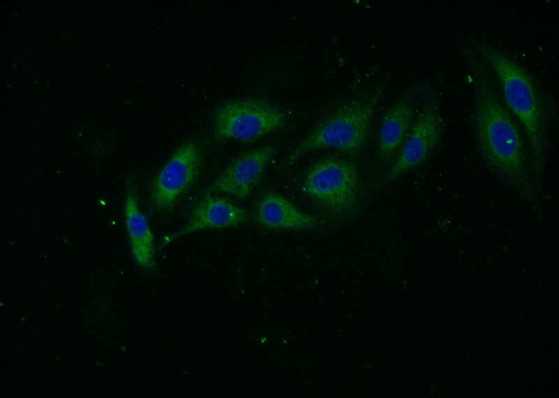 Immunofluorescent analysis of SH-SY5Y cells using Catalog No:115813(STXBP5 Antibody) at dilution of 1:25 and Alexa Fluor 488-congugated AffiniPure Goat Anti-Rabbit IgG(H+L)