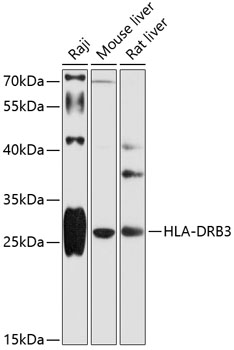 Western blot - HLA-DRB3 Polyclonal Antibody 