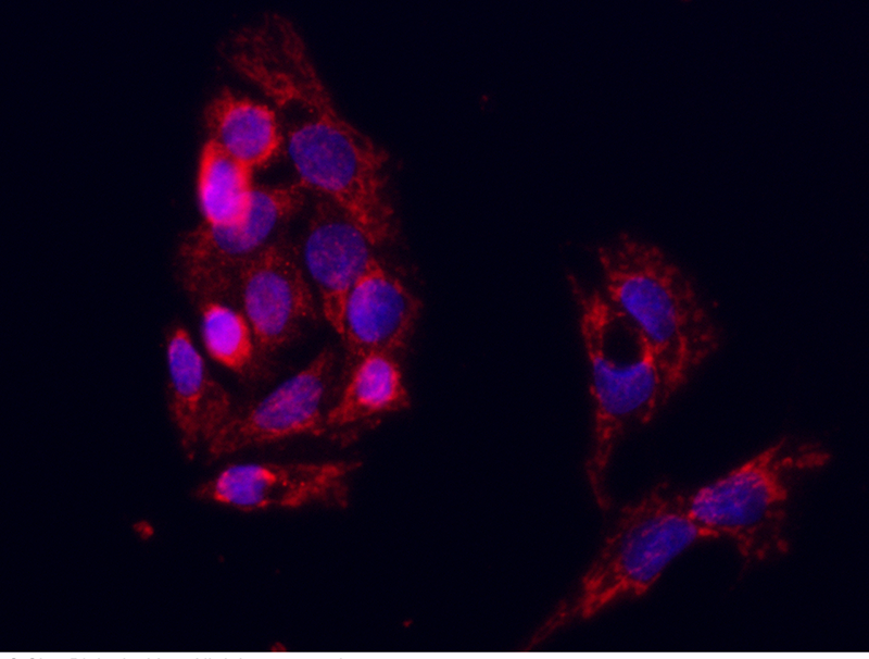 CD103 / Integrin alpha E / ITGAE Antibody, Rabbit PAb, Antigen Affinity Purified, Immunofluorescence
