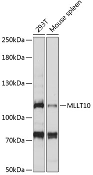 Western blot - MLLT10 Polyclonal Antibody 
