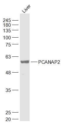 Fig1: Sample:; Liver (Mouse) Lysate at 40 ug; Primary: Anti-PCANAP2 at 1/1000 dilution; Secondary: IRDye800CW Goat Anti-Rabbit IgG at 1/20000 dilution; Predicted band size: 59 kD; Observed band size: 59 kD
