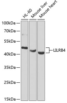 Western blot - LILRB4 Polyclonal Antibody 