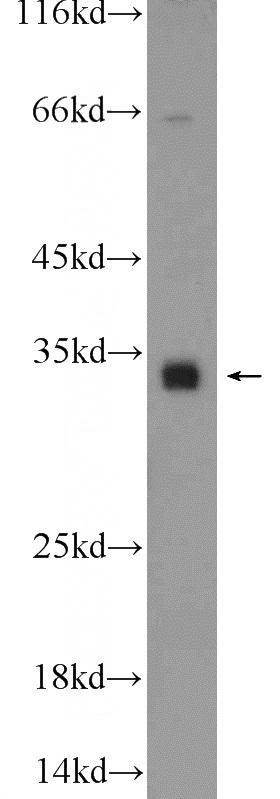 A431 cells were subjected to SDS PAGE followed by western blot with Catalog No:108615(C18orf45 Antibody) at dilution of 1:600