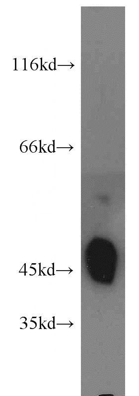 mouse lung tissue were subjected to SDS PAGE followed by western blot with Catalog No:112059(KCNJ12 antibody) at dilution of 1:1500
