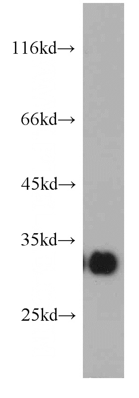 HL-60 cells were subjected to SDS PAGE followed by western blot with Catalog No:112061(KIR2DS4 antibody) at dilution of 1:500