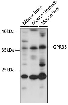 Western blot - GPR35 Polyclonal Antibody 