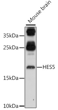 Western blot - HES5 Polyclonal Antibody 