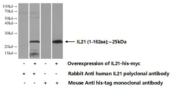 Transfected HEK-293 cells were subjected to SDS PAGE followed by western blot with Catalog No:111777(IL21 Antibody) at dilution of 1:350