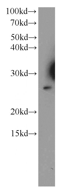 HeLa cells were subjected to SDS PAGE followed by western blot with Catalog No:115950(TESC antibody) at dilution of 1:300