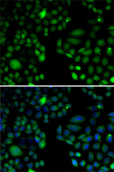 Immunofluorescence - EPC1 Polyclonal Antibody 