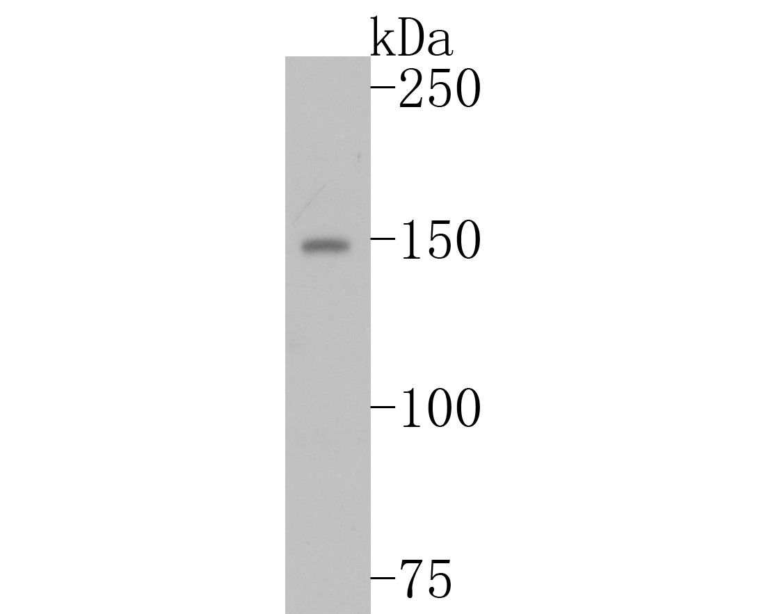 Fig1:; Western blot analysis of Ret on MCF-7 cell lysates. Proteins were transferred to a PVDF membrane and blocked with 5% BSA in PBS for 1 hour at room temperature. The primary antibody ( 1/500) was used in 5% BSA at room temperature for 2 hours. Goat Anti-Rabbit IgG - HRP Secondary Antibody (HA1001) at 1:5,000 dilution was used for 1 hour at room temperature.
