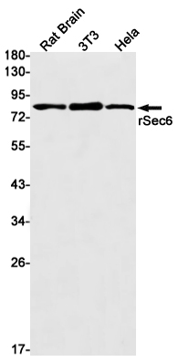 Western blot detection of rSec6 in Rat Brain,3T3,Hela cell lysates using rSec6 Rabbit mAb(1:1000 diluted).Predicted band size:87kDa.Observed band size:87kDa.