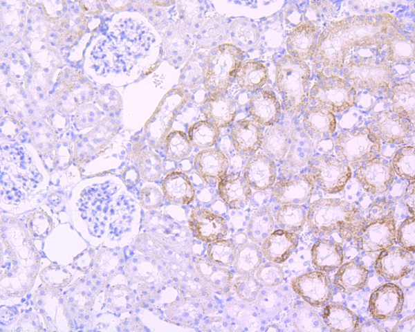 Fig7:; Immunohistochemical analysis of paraffin-embedded rat kidney tissue using anti-Sonic Hedgehog Protein antibody. Counter stained with hematoxylin.