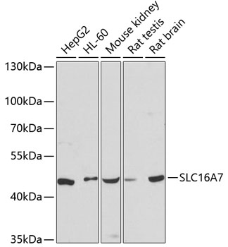 Western blot - SLC16A7 Polyclonal Antibody 