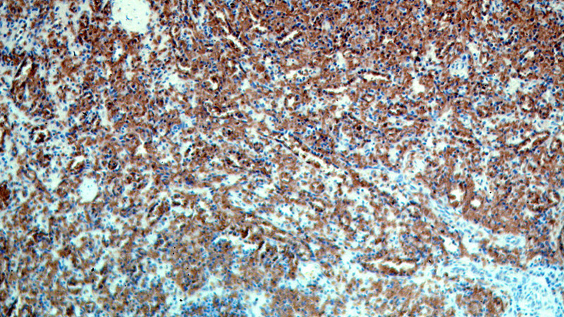 Immunohistochemical of paraffin-embedded human spleen using Catalog No:108417(SLC4A1 antibody) at dilution of 1:50 (under 10x lens)