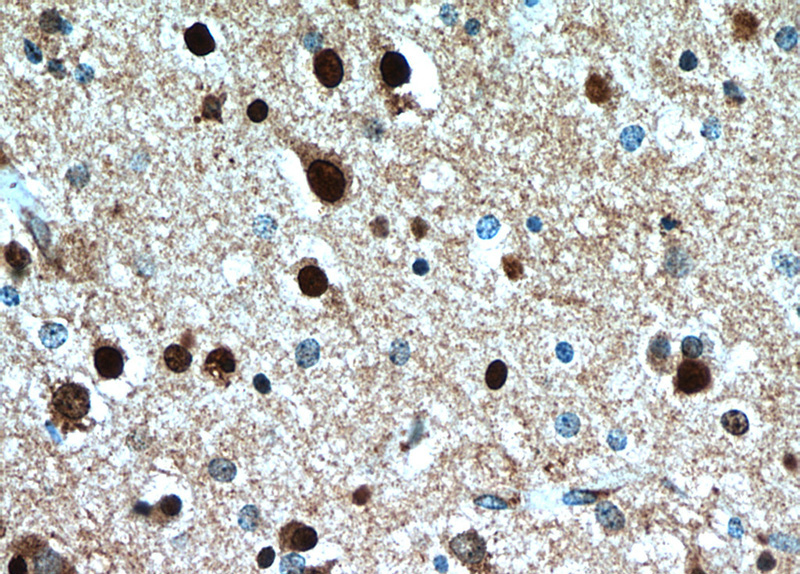 Immunohistochemical of paraffin-embedded human brain using Catalog No:110781(FSD1L antibody) at dilution of 1:50 (under 40x lens)