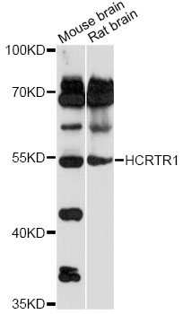 Western blot - HCRTR1 Polyclonal Antibody 