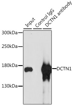 Immunoprecipitation - DCTN1 Polyclonal Antibody 