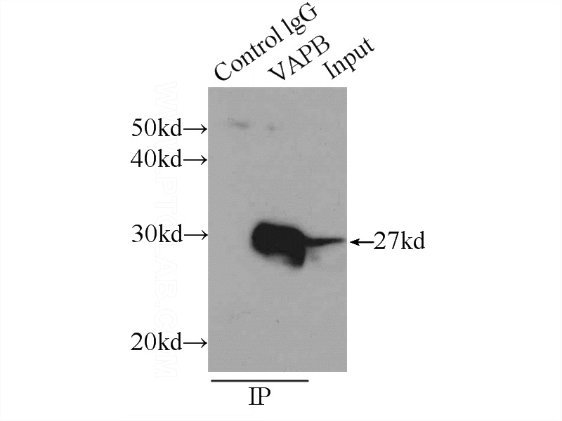 IP Result of anti-VAPB (IP:Catalog No:116715, 3ug; Detection:Catalog No:116715 1:800) with HeLa cells lysate 1840ug.
