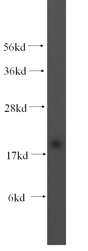 HepG2 cells were subjected to SDS PAGE followed by western blot with Catalog No:112775(NUDT1 antibody) at dilution of 1:300