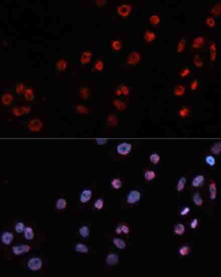 Immunofluorescence - MT2A Polyclonal Antibody 