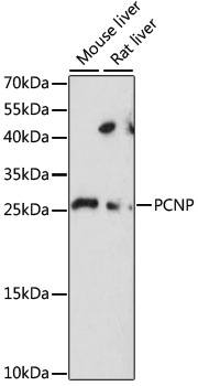 Western blot - PCNP Polyclonal Antibody 