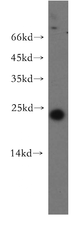 human testis tissue were subjected to SDS PAGE followed by western blot with Catalog No:109337(CLDN11 antibody) at dilution of 1:500