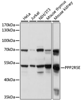 Western blot - PPP2R5E Polyclonal Antibody 