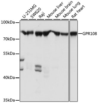 Western blot - GPR108 Polyclonal Antibody 