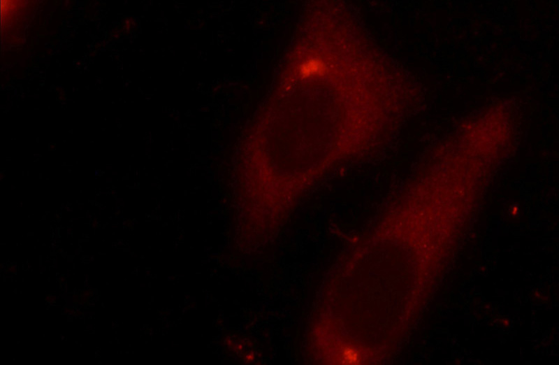 Immunofluorescent analysis of Ethacrynic acid treated HepG2 cells using Catalog No:109827(DDX3 Antibody) at dilution of 1:25 and Rhodamine-Goat anti-Rabbit IgG