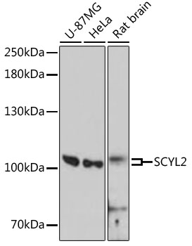 Western blot - SCYL2 Polyclonal Antibody 