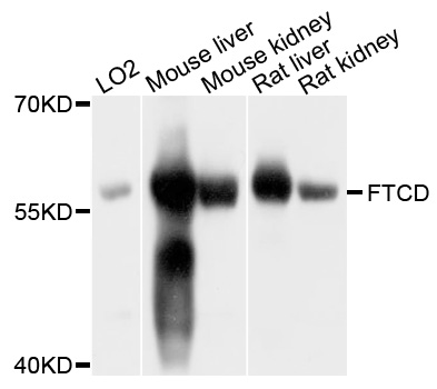 Western blot - FTCD Polyclonal Antibody 