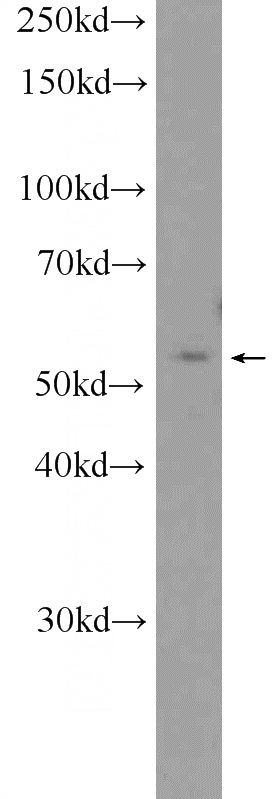 SMMC-7721 cells were subjected to SDS PAGE followed by western blot with Catalog No:108920(CAMK2G Antibody) at dilution of 1:2000