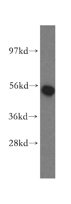 human liver tissue were subjected to SDS PAGE followed by western blot with Catalog No:112956(NARS2 antibody) at dilution of 1:500