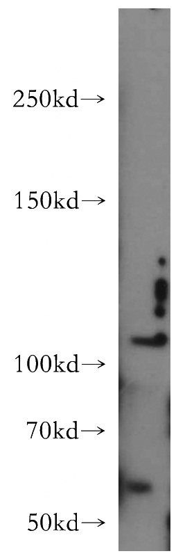 HeLa cells were subjected to SDS PAGE followed by western blot with Catalog No:109363(CNTN4 antibody) at dilution of 1:300