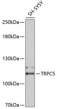 Western blot - TRPC5 Polyclonal Antibody 