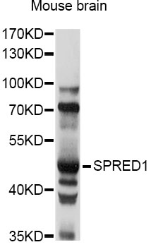 Western blot - SPRED1 Polyclonal Antibody 
