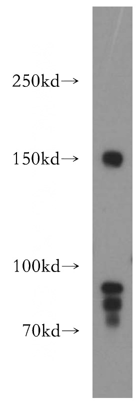 mouse brain tissue were subjected to SDS PAGE followed by western blot with Catalog No:113982(PNPLA6 antibody) at dilution of 1:500