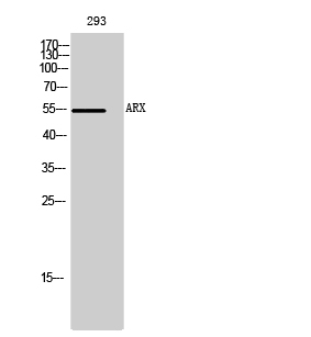 Fig1:; Western Blot analysis of 293 cells using ARX Polyclonal Antibody cells nucleus extracted by Minute TM Cytoplasmic and Nuclear Fractionation kit (SC-003,Inventbiotech,MN,USA).