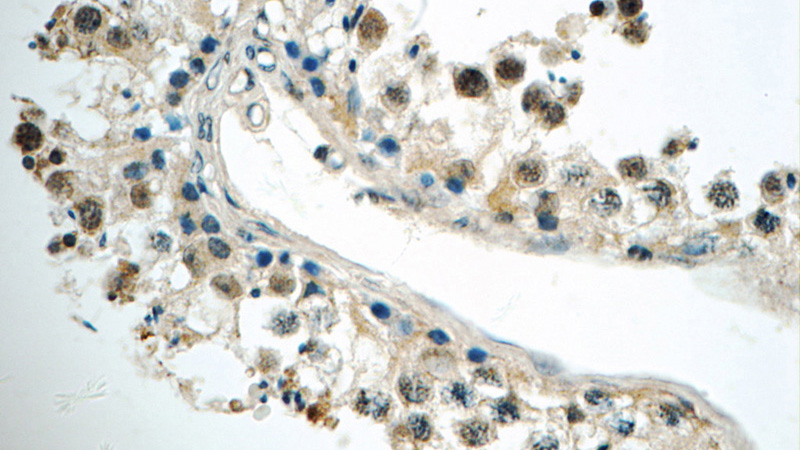 Immunohistochemistry of paraffin-embedded human testis tissue slide using Catalog No:111305(HEXIM2 Antibody) at dilution of 1:50 (under 40x lens)
