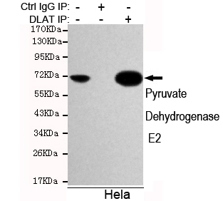Immunoprecipitation analysis of Hela cell lysates using Pyruvate Dehydrogenase E2 mouse mAb.