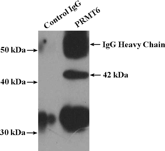 IP Result of anti-PRMT6 (IP:Catalog No:114208, 4ug; Detection:Catalog No:114208 1:1500) with HEK-293 cells lysate 2400ug.