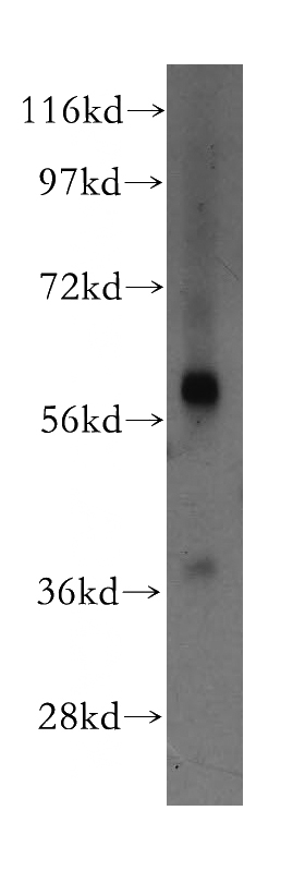mouse brain tissue were subjected to SDS PAGE followed by western blot with Catalog No:111075(GLUD2 antibody) at dilution of 1:500