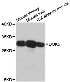 Western blot - DOK5 Polyclonal Antibody 