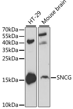 Western blot - SNCG Polyclonal Antibody 