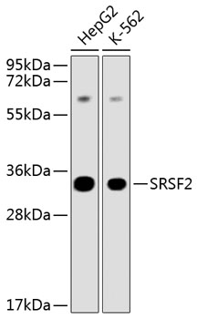 Western blot - SFRS2 Polyclonal Antibody 