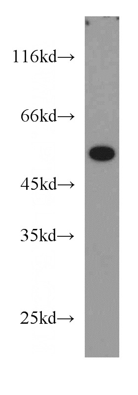 mouse skeletal muscle tissue were subjected to SDS PAGE followed by western blot with Catalog No:109484(COX15 antibody) at dilution of 1:1000