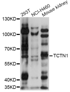 Western blot - TCTN1 Polyclonal Antibody 