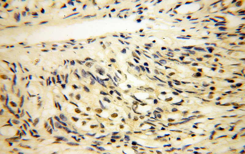 Immunohistochemical of paraffin-embedded human ovary using Catalog No:112179(LDB1 antibody) at dilution of 1:50 (under 40x lens)