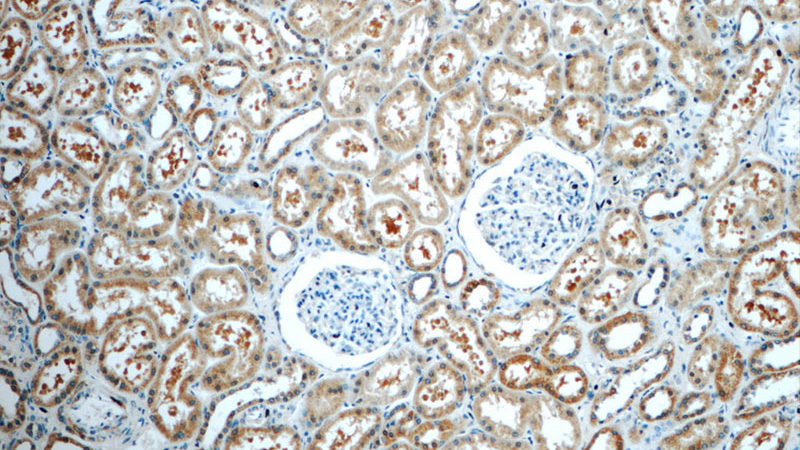 Immunohistochemistry of paraffin-embedded human kidney tissue slide using Catalog No:111563(HSN2 Antibody) at dilution of 1:50 (under 10x lens)